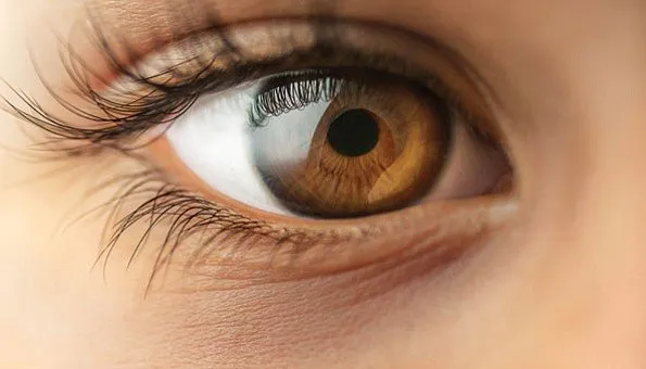 Glaucoma