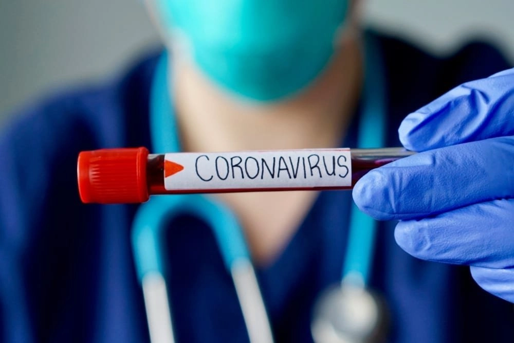 coronavirus 7.jpg