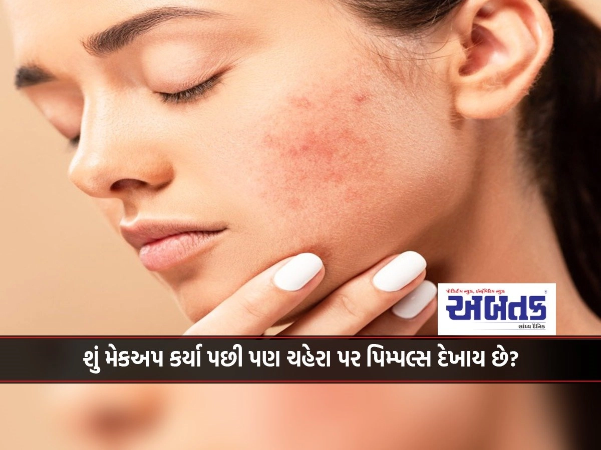 Pimples appear on the face even after makeup? So follow these tips