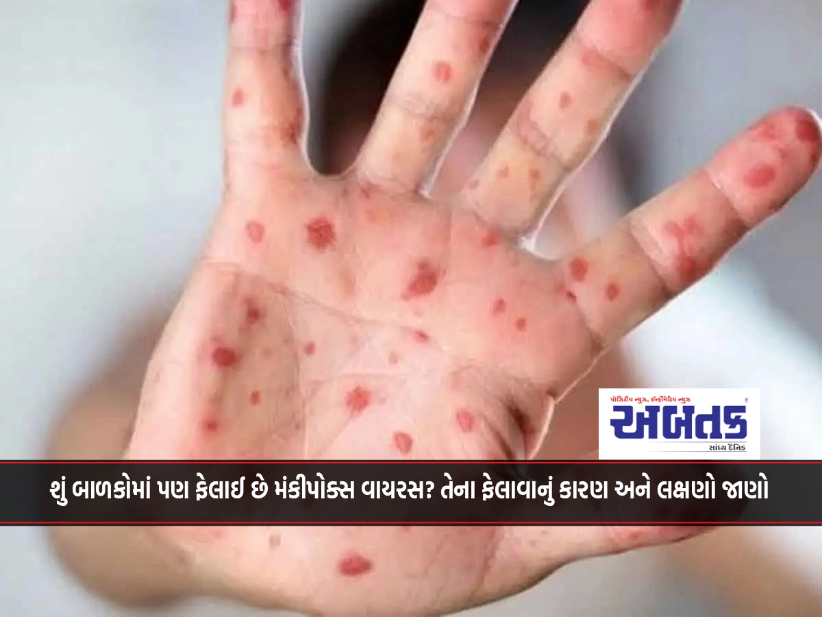 Has the monkeypox virus spread to children? Know the cause and symptoms of its spread