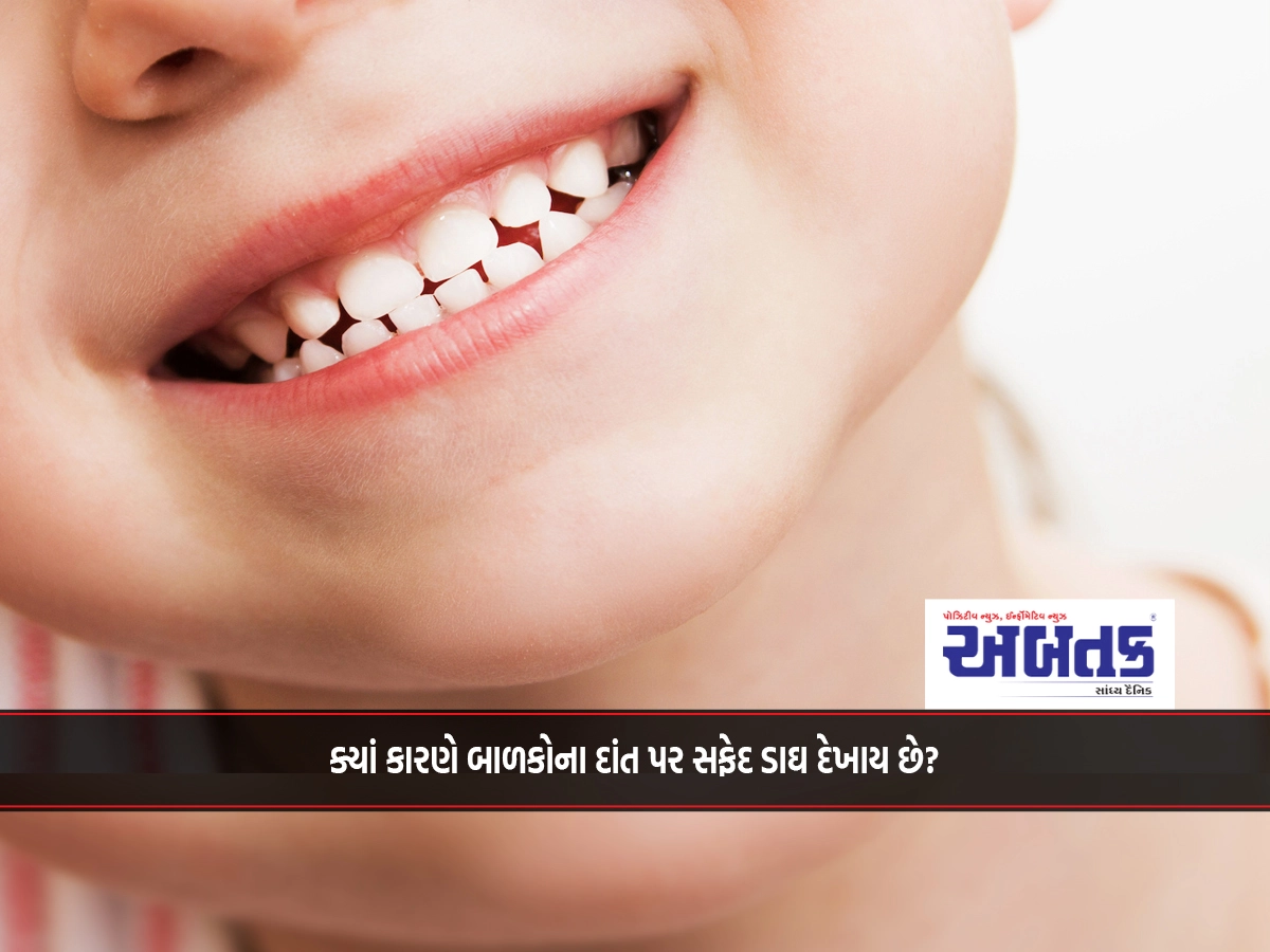 What causes white spots on children's teeth?