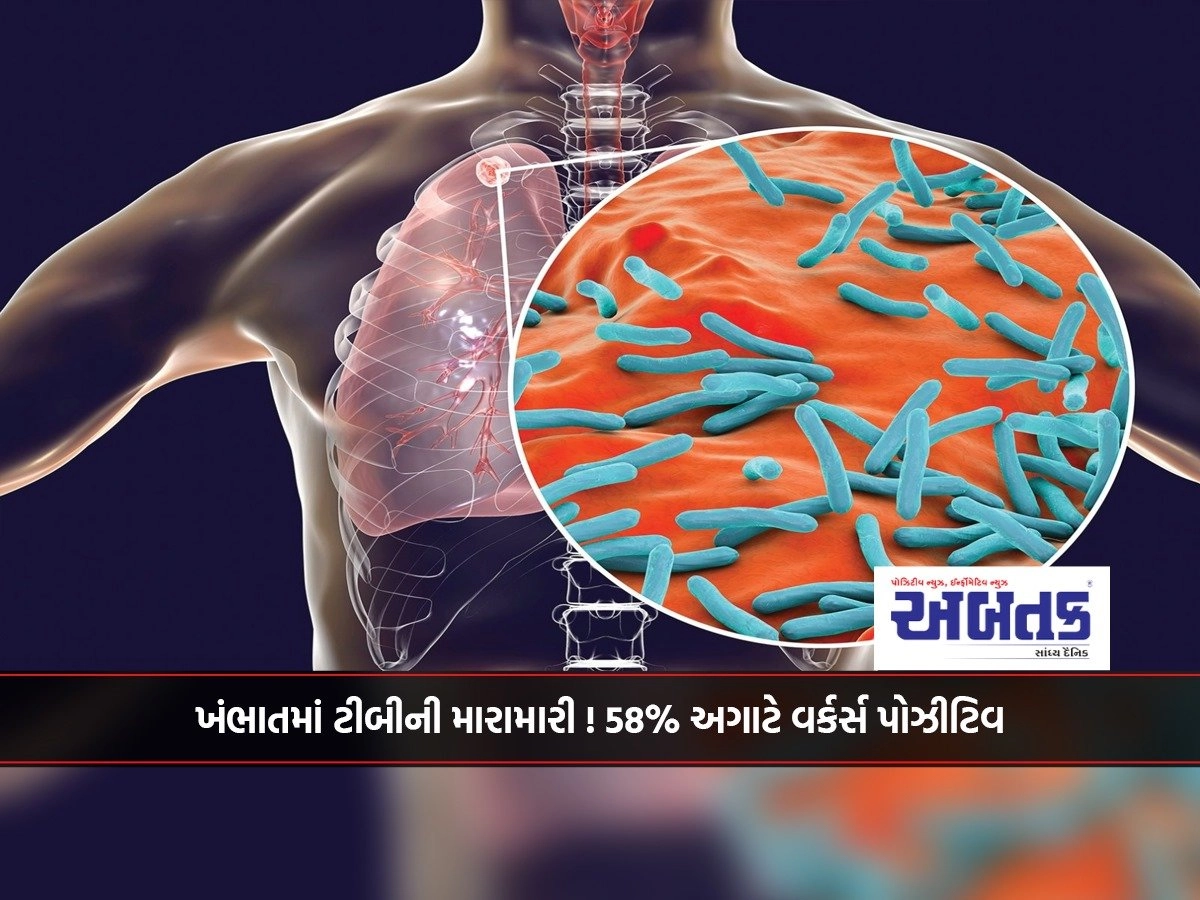 TB attacks in Khambhat! 58% of Agate workers positive