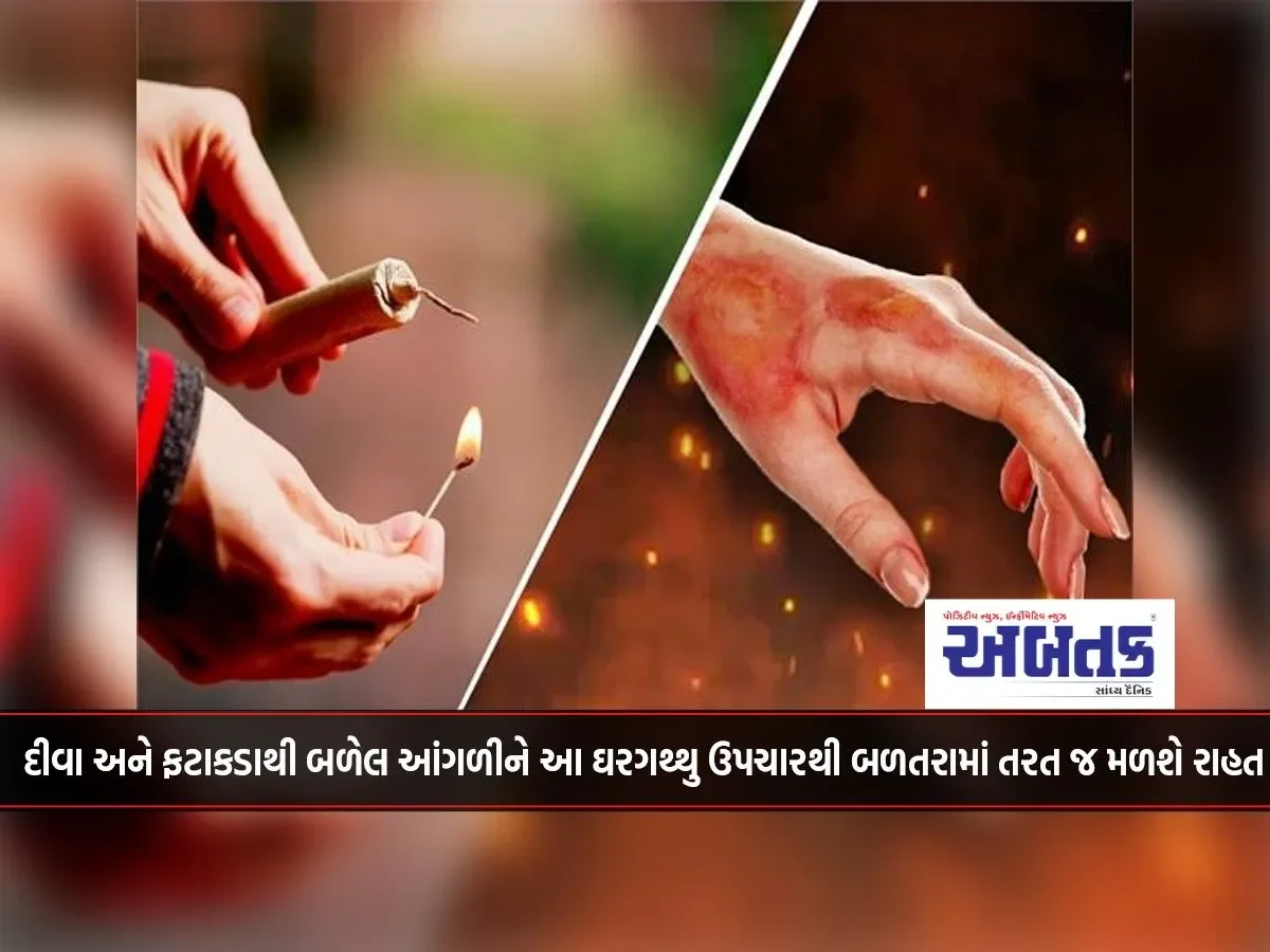 Fingers Burnt By Lamps And Crackers Will Get Immediate Relief From The Inflammation With This Home Remedy