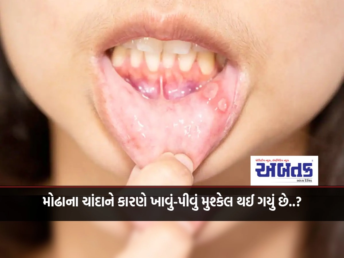 Mouth ulcers have made eating and drinking difficult..?