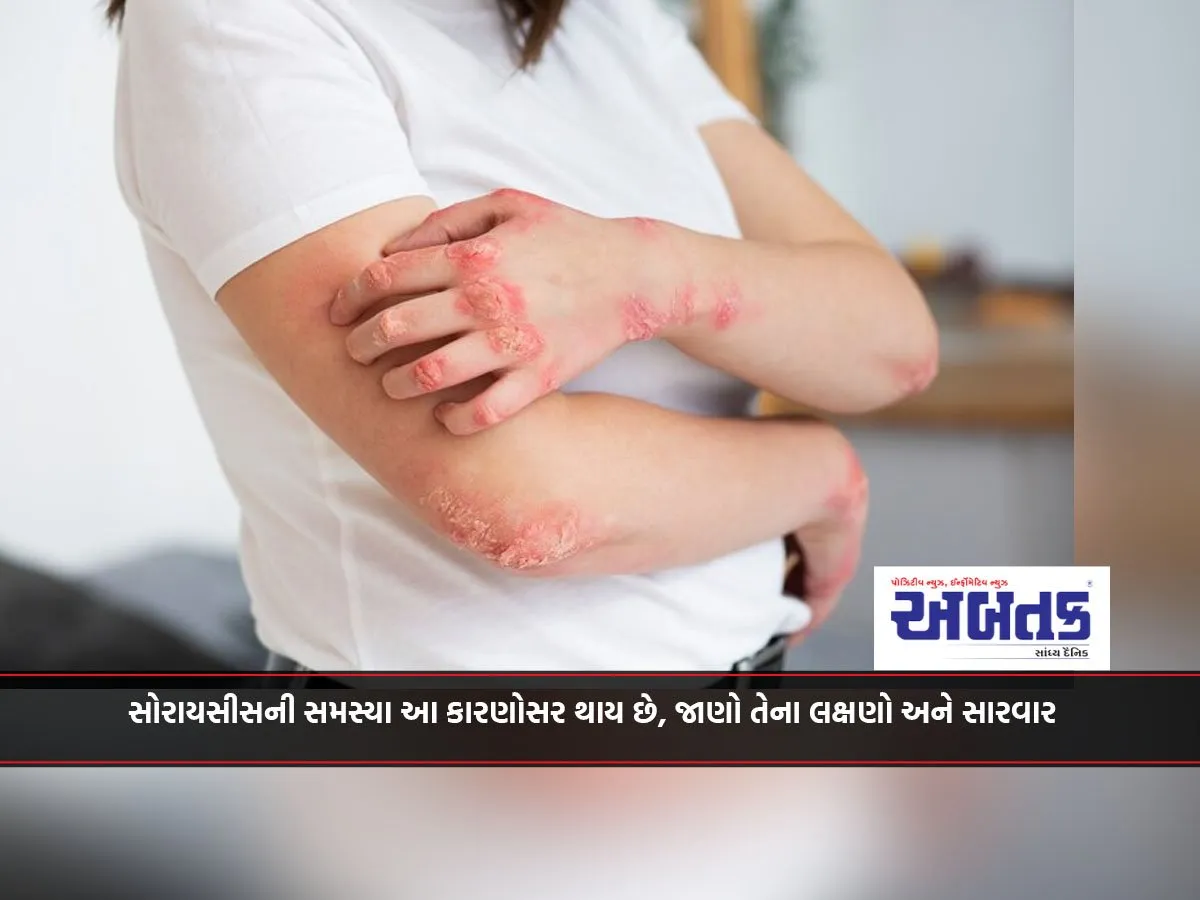 World Psoriasis Day : Psoriasis Problem Occurs For These Reasons, Know Its Symptoms And Treatment