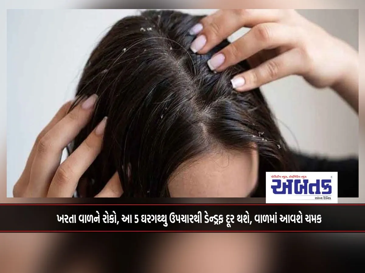 Stop Hair Fall, These 5 Home Remedies Will Get Rid Of Dandruff, Make Hair Shiny