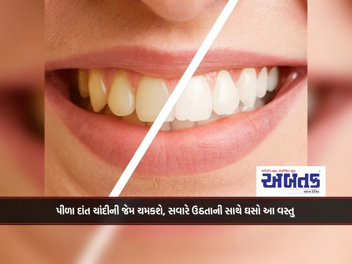 Yellow Teeth Will Shine Like Silver, Rub This Stuff As Soon As You Wake Up In The Morning