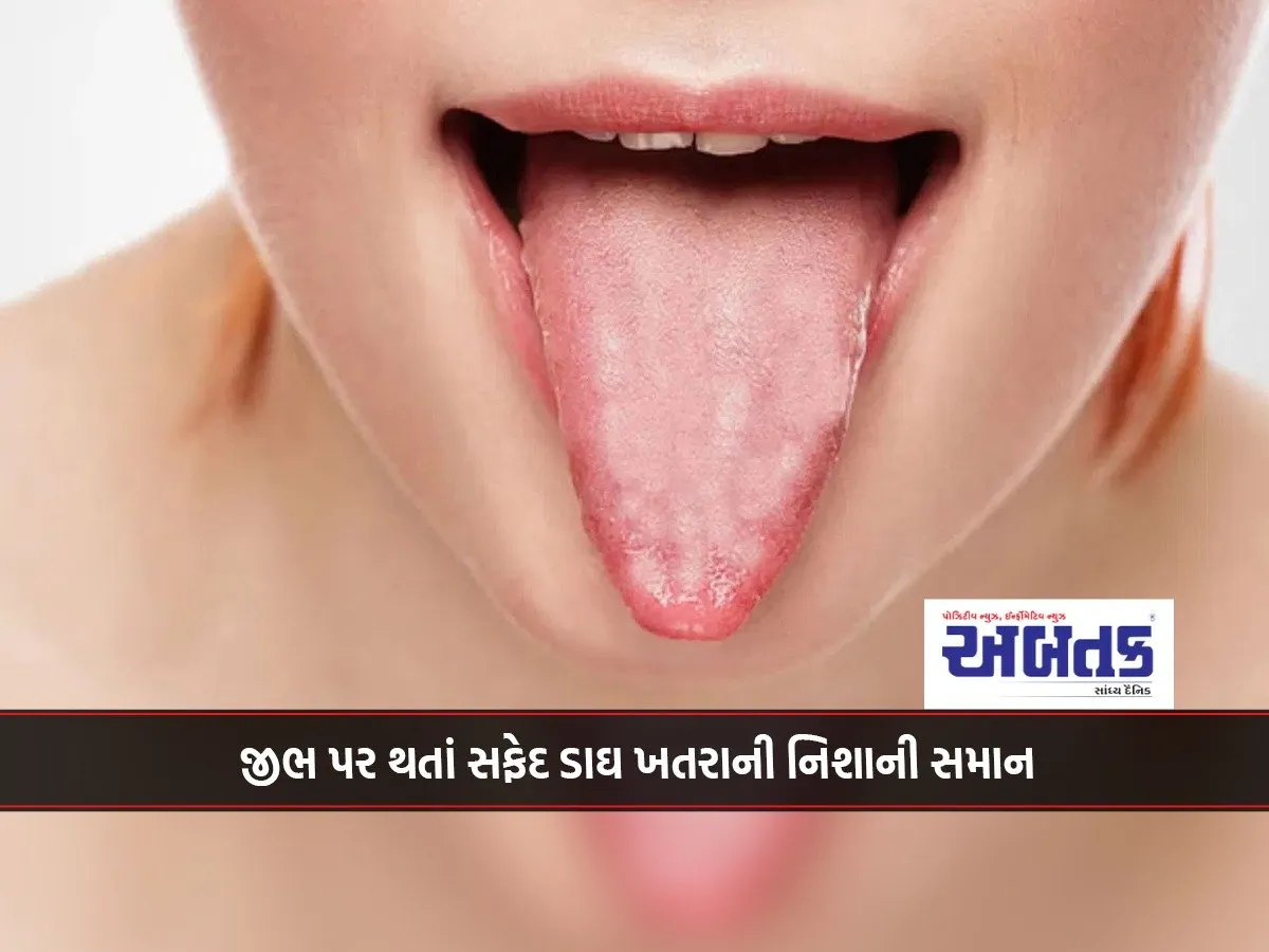 A White Spot On The Tongue Is A Sign Of Danger