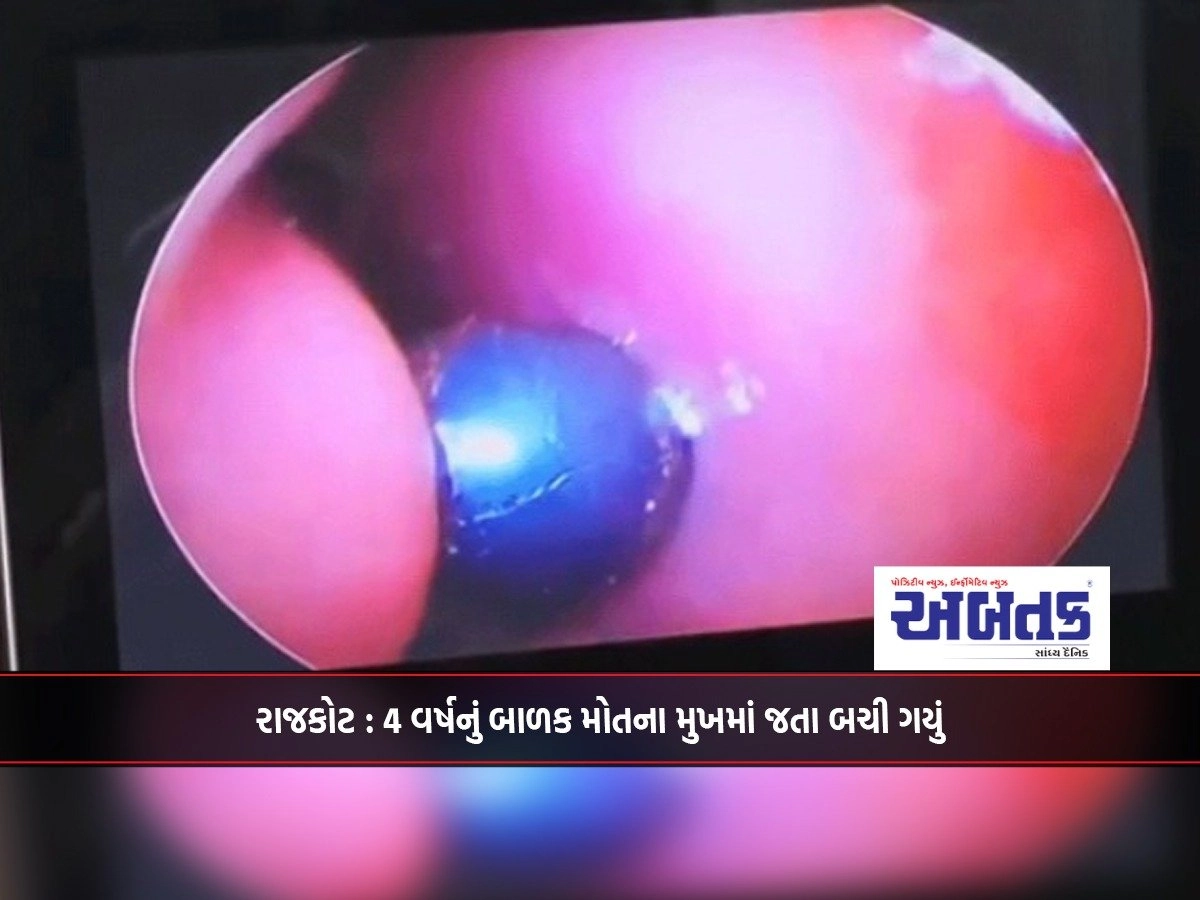 Rajkot: A 4-year-old child escaped death