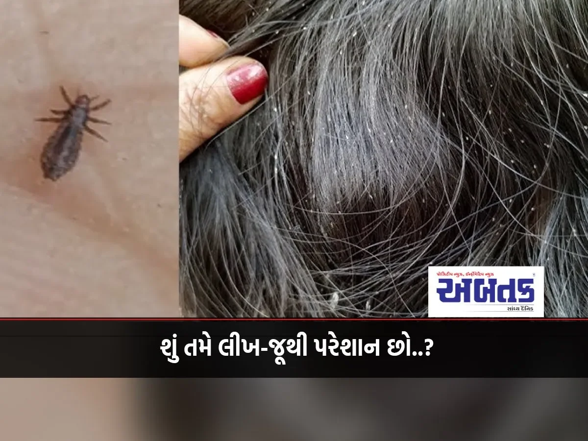 Nit-Lice Remedies:
