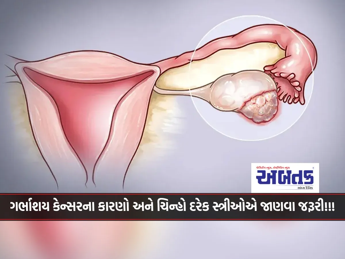 Causes And Signs Of Uterine Cancer Every Woman Must Know!!!