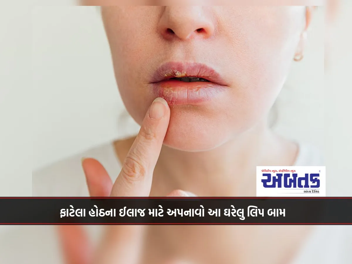 Use This Homemade Lip Balm To Treat Chapped Lips