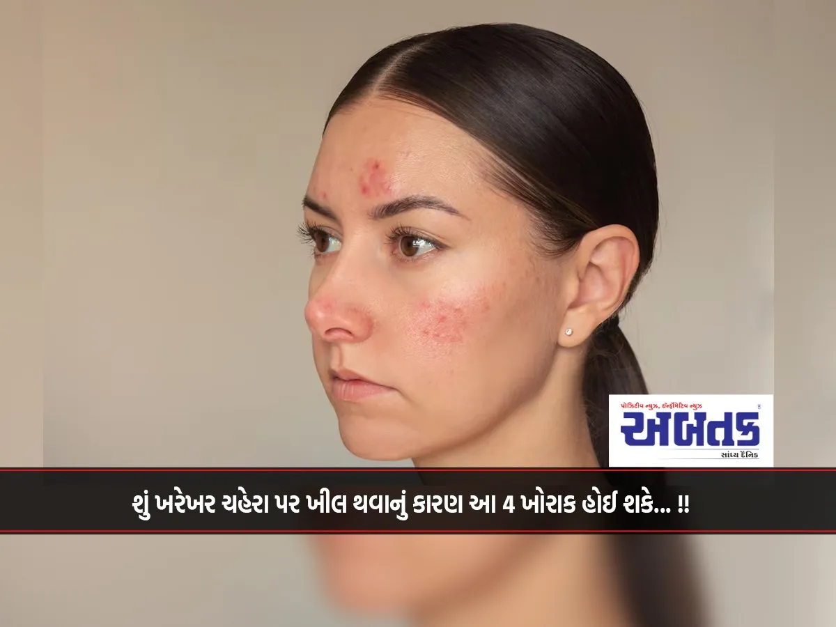 Could These 4 Foods Really Be The Cause Of Acne On The Face...!!