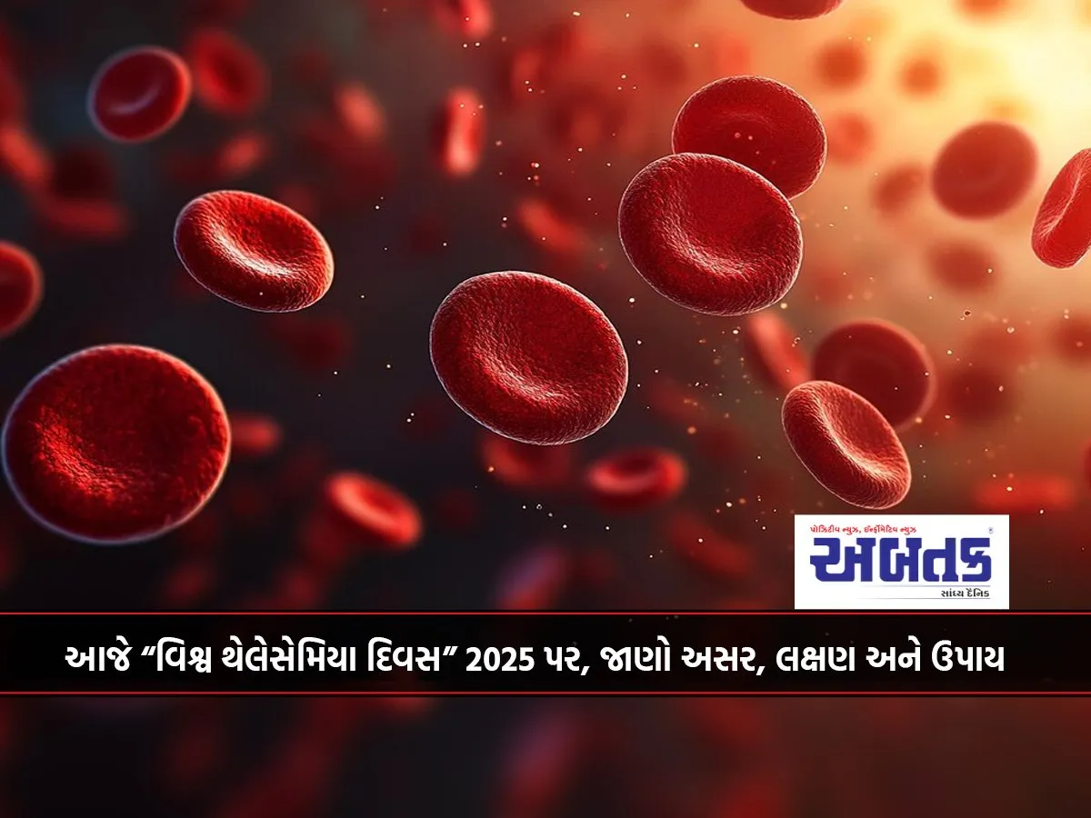 Today On “World Thalassemia Day” 2025, Know The Effects, Symptoms And Remedies