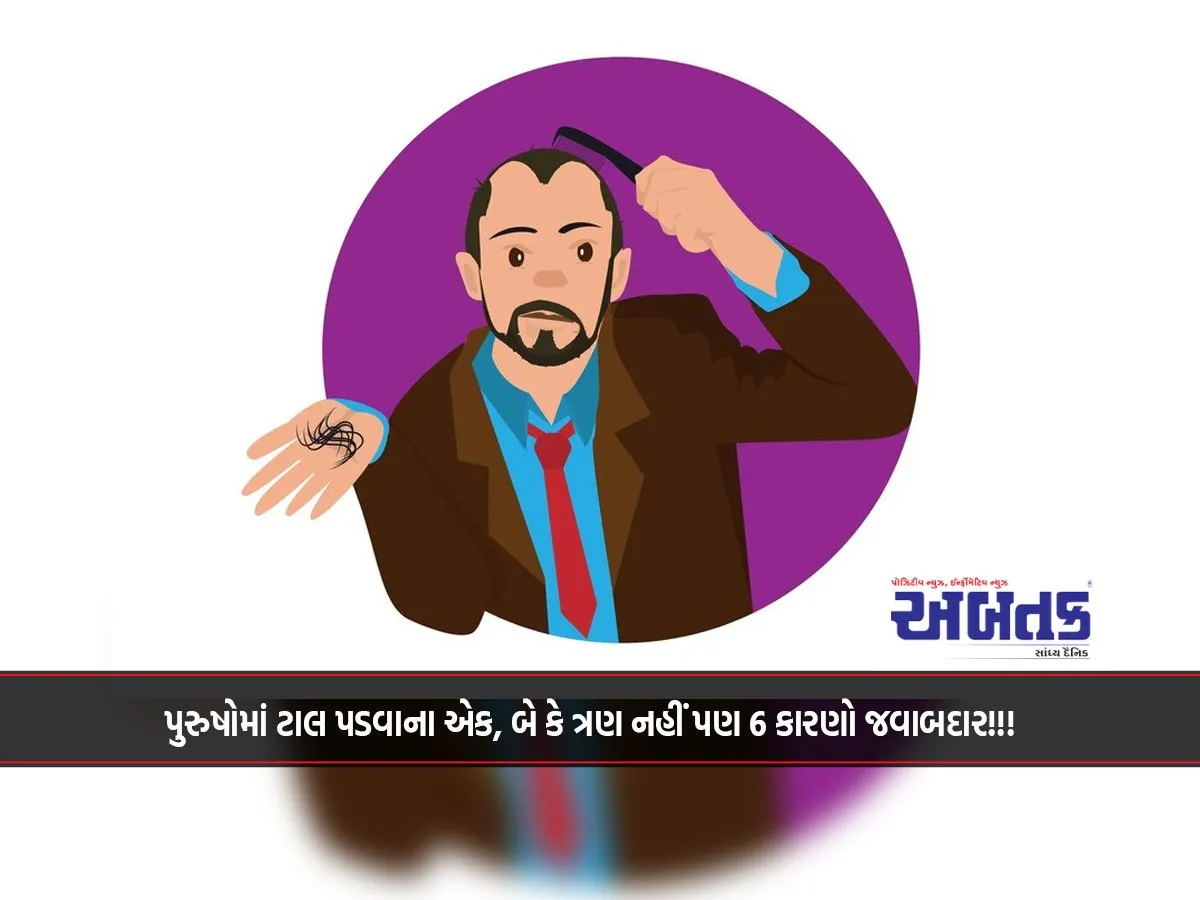 Not One, Two Or Three, But 6 Reasons Are Responsible For Male Pattern Baldness!!!