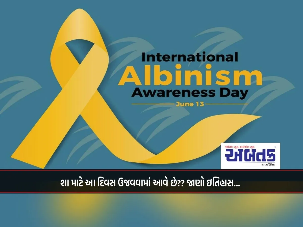 International Albinism Awareness Day 2025: Why Is This Day Celebrated?? Know The History