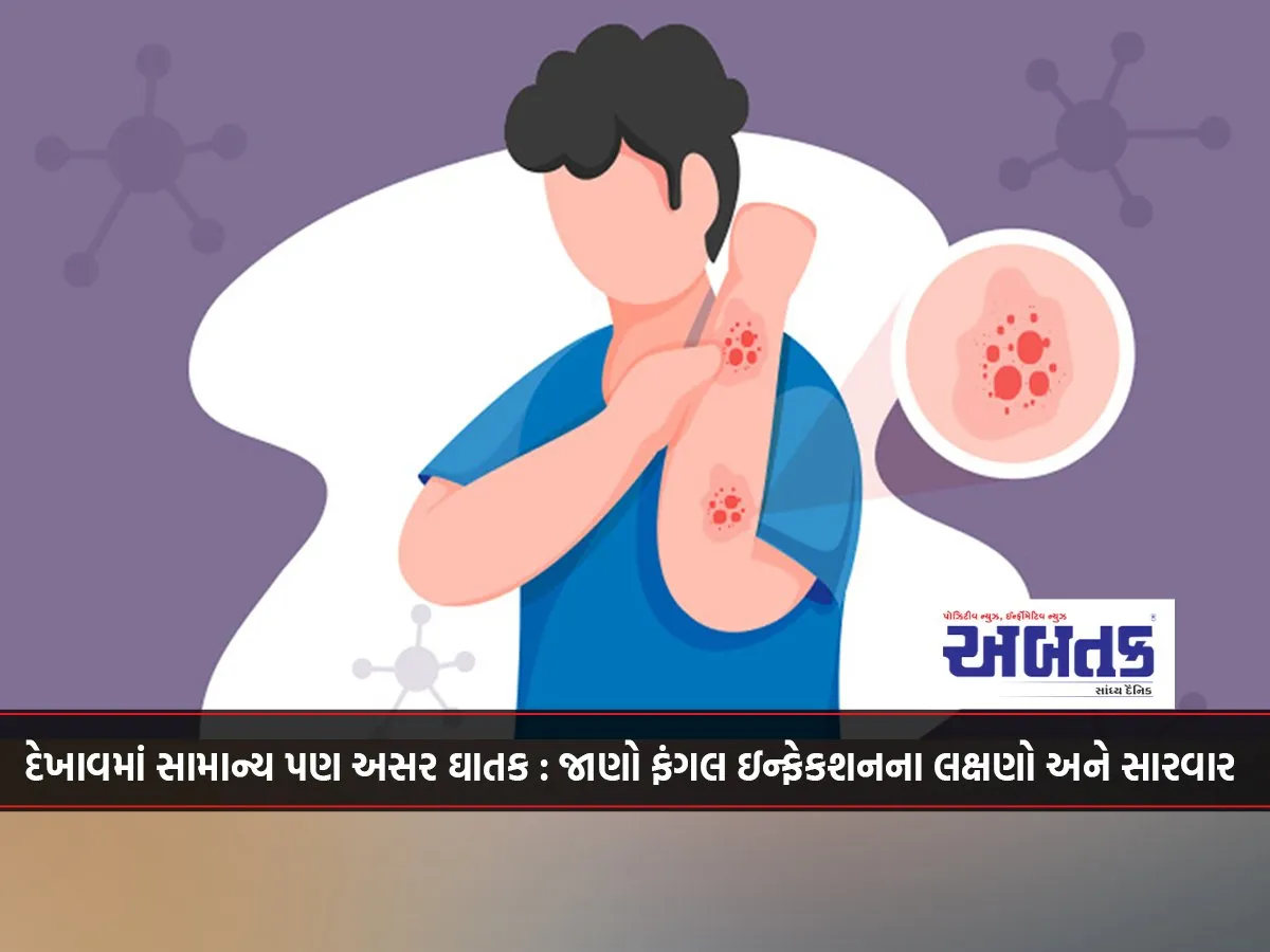Common In Appearance But Deadly In Effect: Know The Symptoms And Treatment Of Fungal Infection