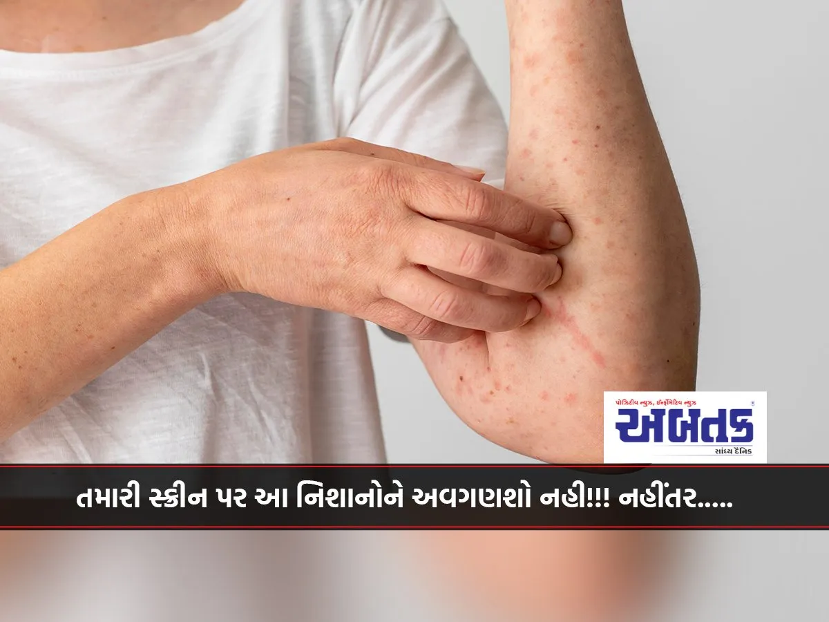 On'T Ignore These Signs On Your Skin!!!