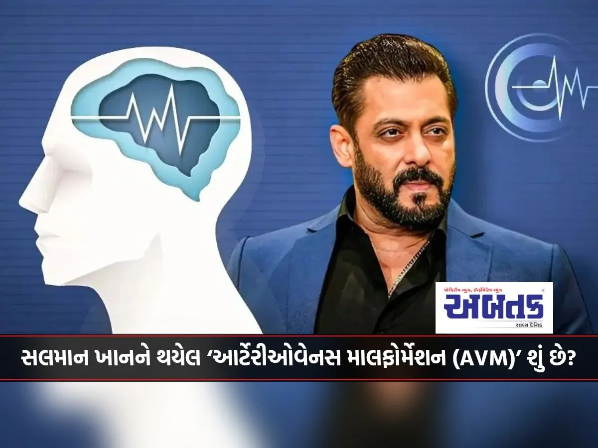 What Is Salman Khan'S 'Arteriovenous Malformation (Avm)'? Know Its Risks And Effects