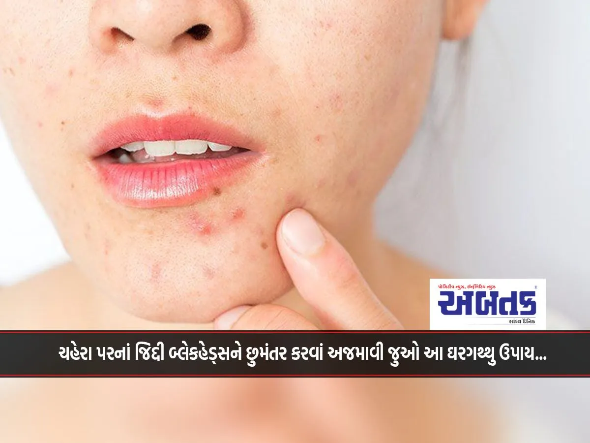 Try This Home Remedy To Get Rid Of Stubborn Blackheads On Your Face...