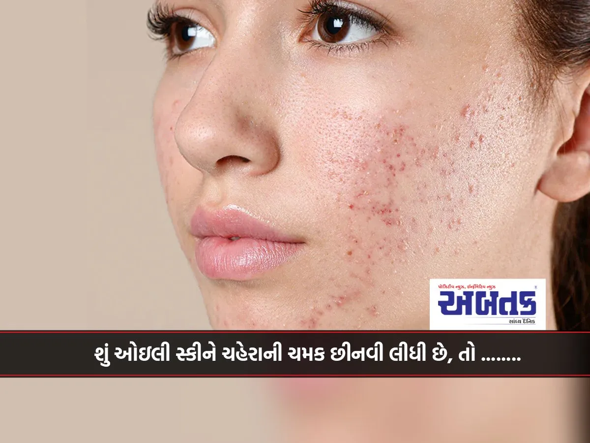 Oily Skin